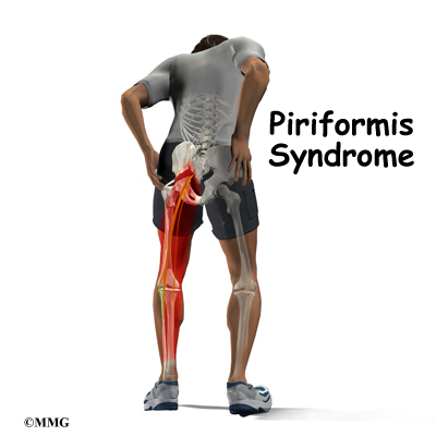 piriformis intro01
